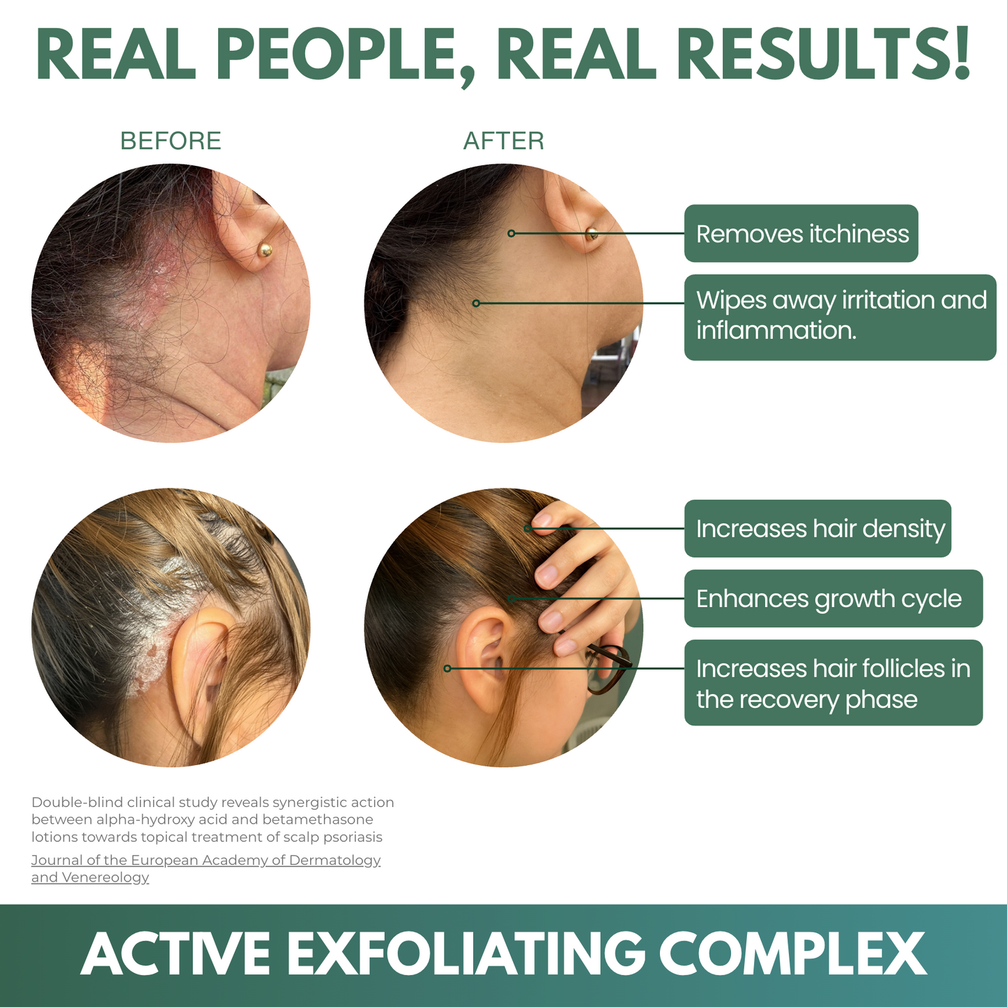 Aerivynox Natural Scalp Scrub