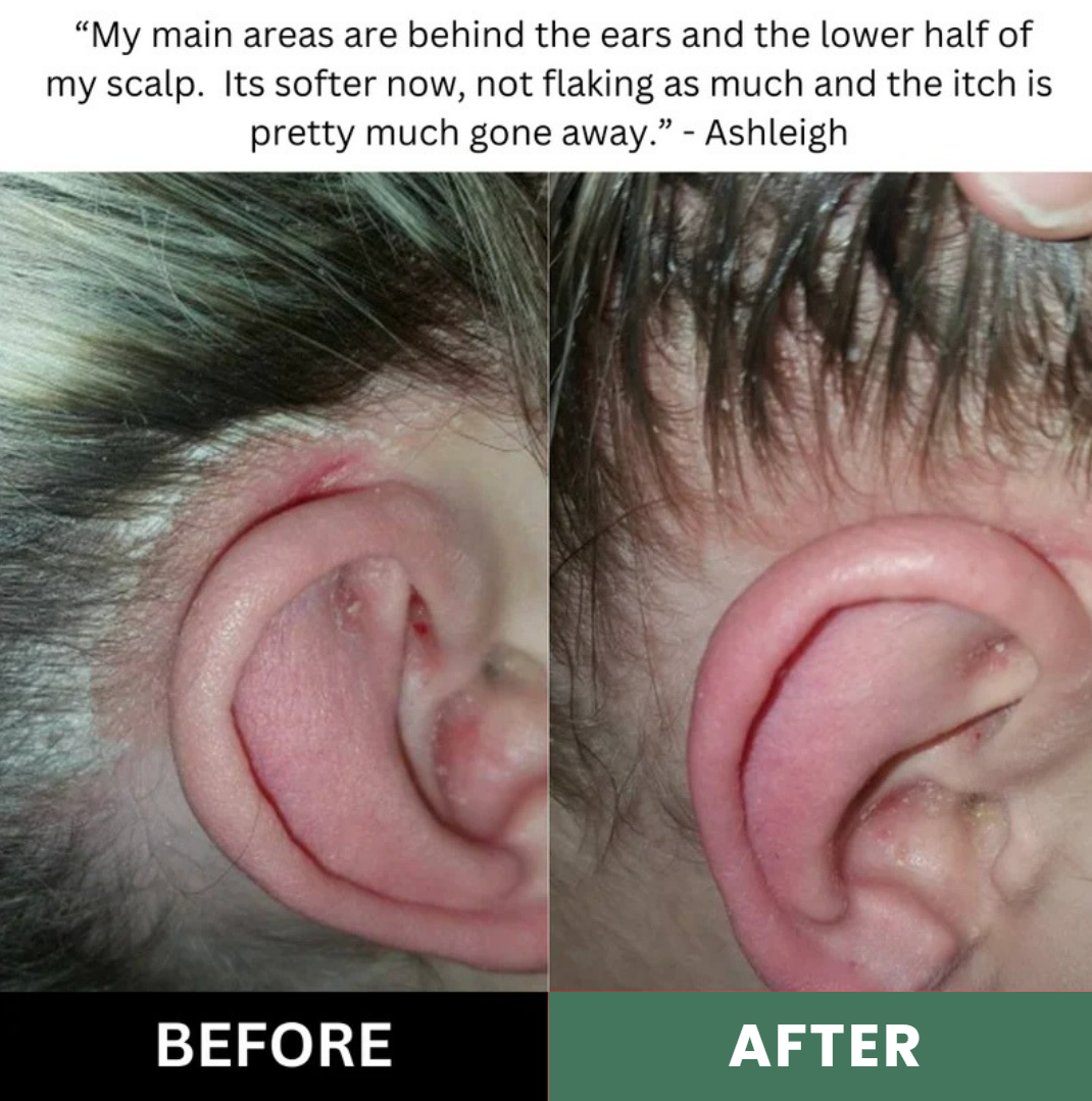 Aerivynox Natural Scalp Scrub