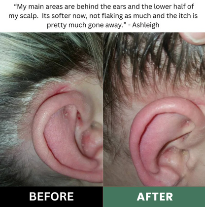 Aerivynox Natural Scalp Scrub