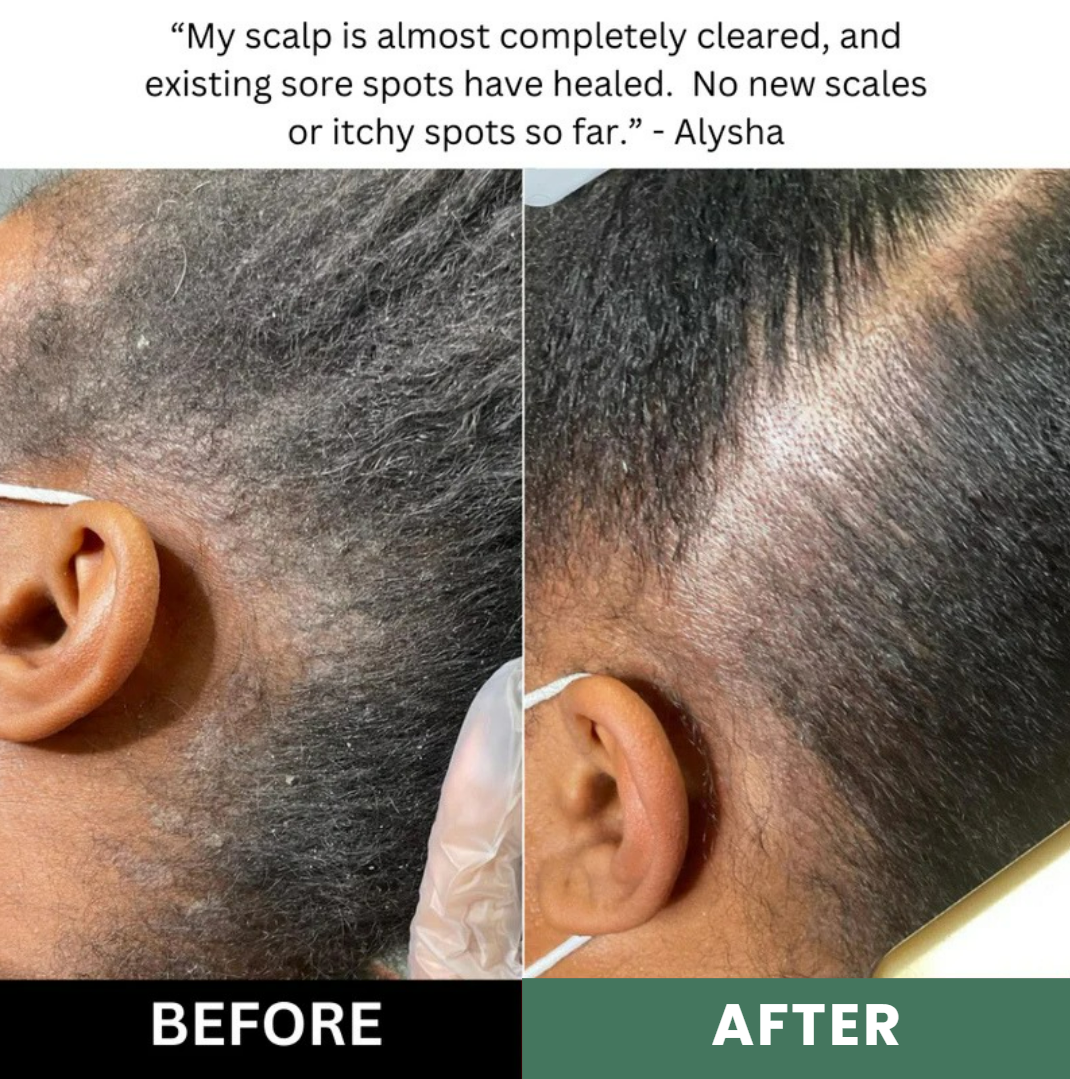 Aerivynox Natural Scalp Scrub