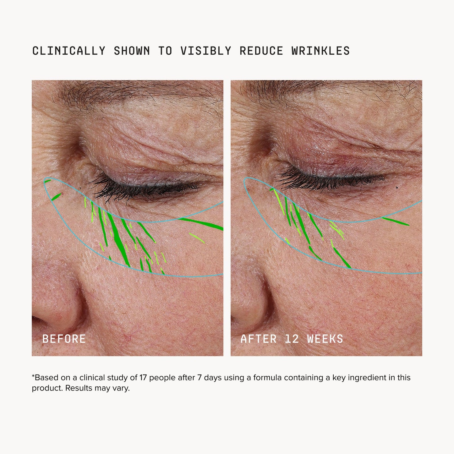 Aerivynox Needle-free Growth Factor Serum