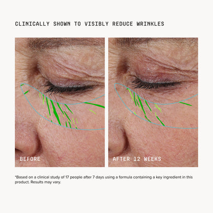 Aerivynox Needle-free Growth Factor Serum