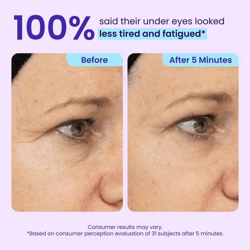 Instant Lift Eye Gel